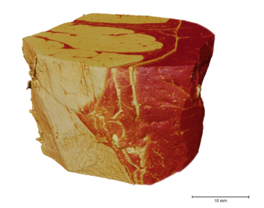 Prosciutto Ham (proxy for Breast Cancer) Prosciutto Ham (proxy for Breast Cancer)